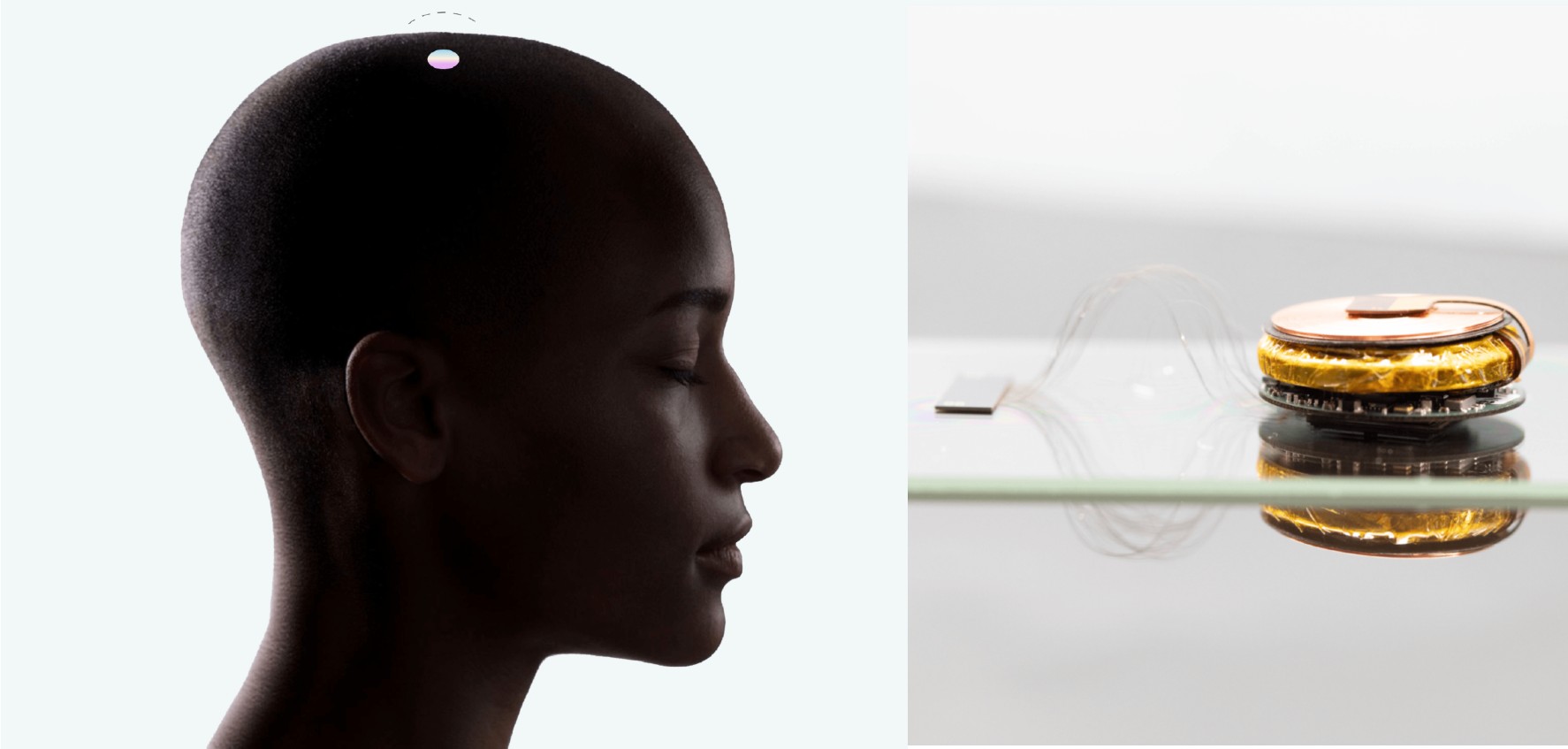 neuralink implant